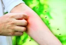 Mosquitos adoram-te no verão Este é o motivo